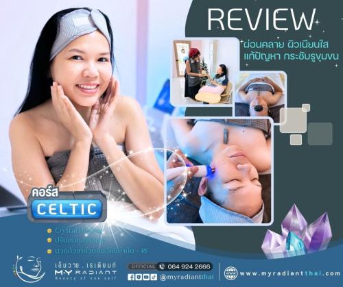 รีวิวคอร์สกัวซา-CELTIC-เอ็มวายเรเดียนท์-RFกระชับผิว